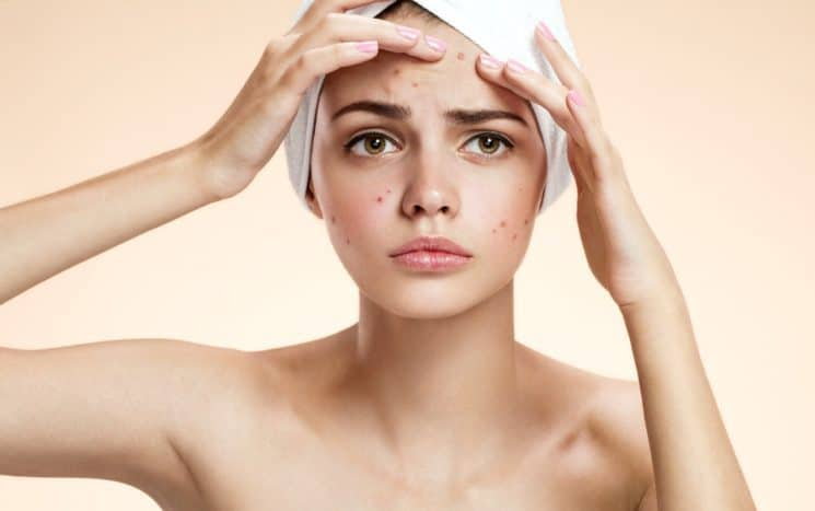 Penting Cara Mengenali Jenis Kulit Dan Cara Merawatnya