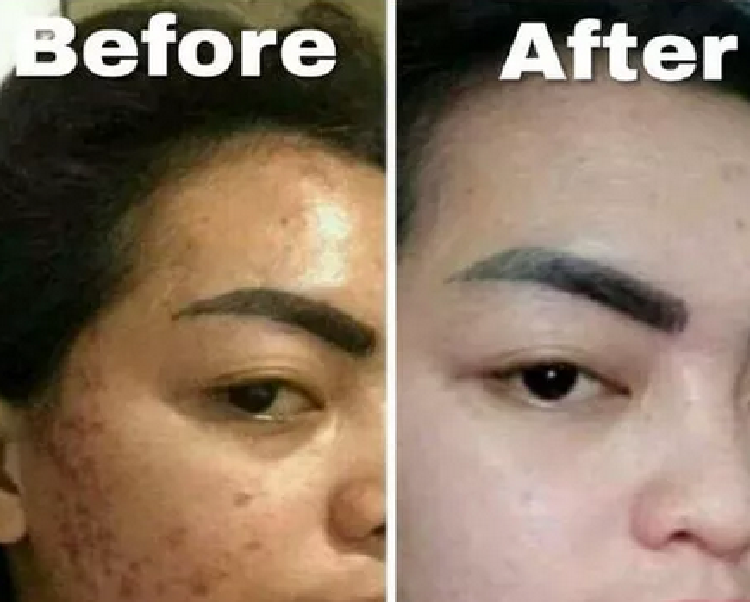 Waspada Pemutih Abal Abal Yang Ada Dipasaran