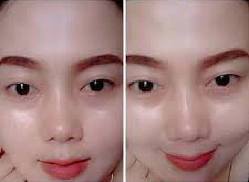 Waspada Pemutih Abal Abal Yang Ada Dipasaran