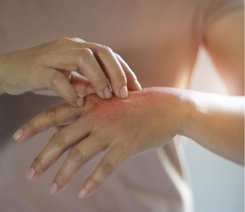 Awas Bahaya Lotion Pemutih Abal Abal