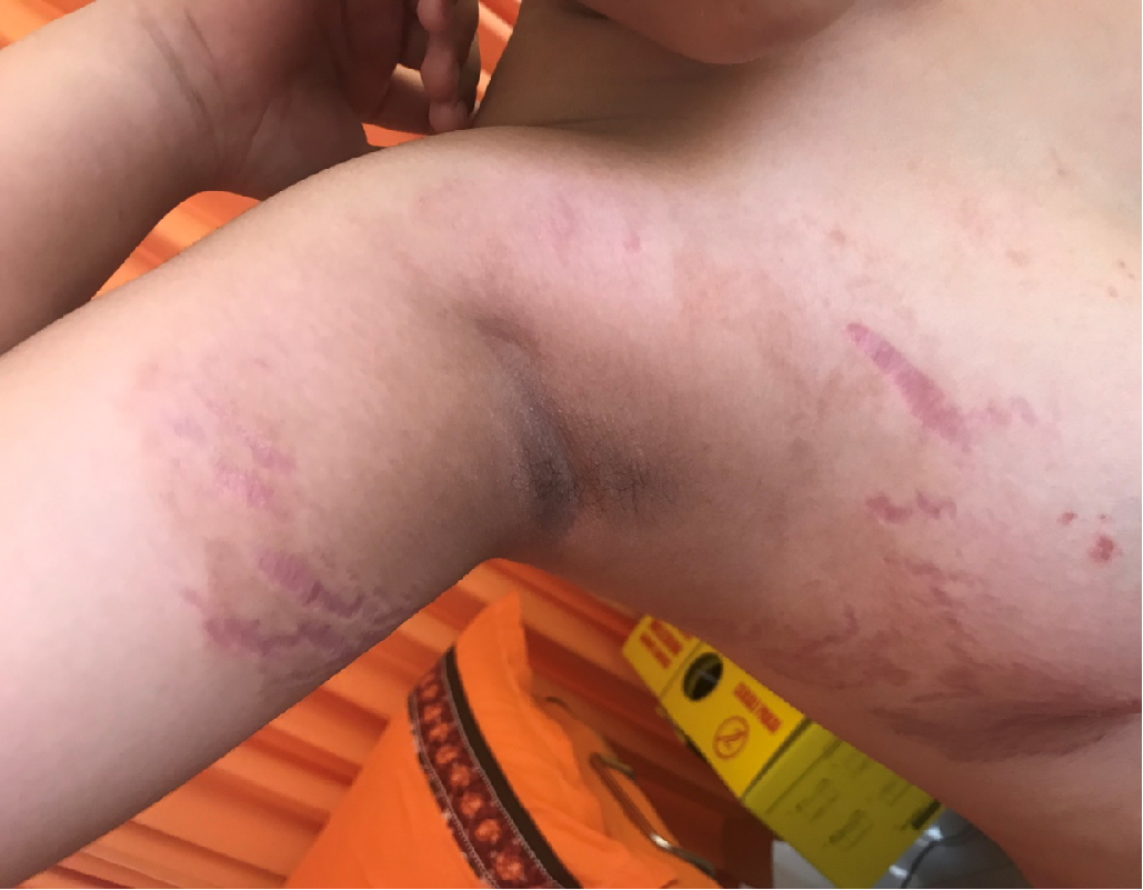 Awas Bahaya Lotion Pemutih Abal Abal