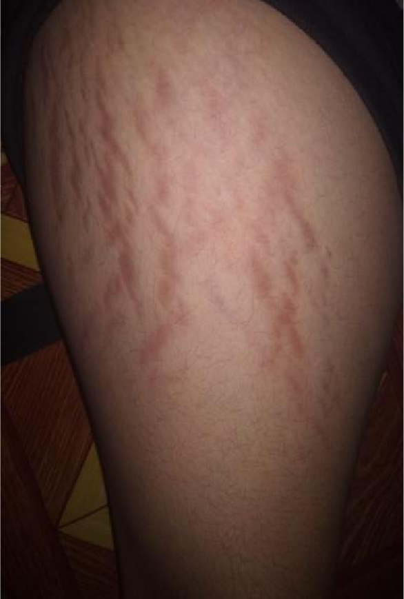 Awas Bahaya Lotion Pemutih Abal Abal