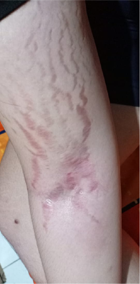 Awas Bahaya Lotion Pemutih Abal Abal