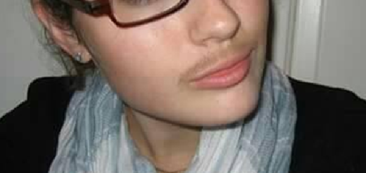 Inilah Bahaya Dari Cream Steroid